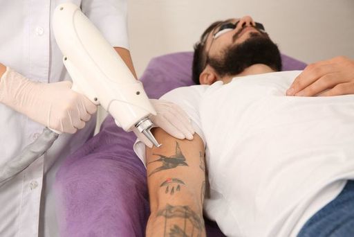 Laser-Tattoo-Removal-Near-Harley-Street.jpg