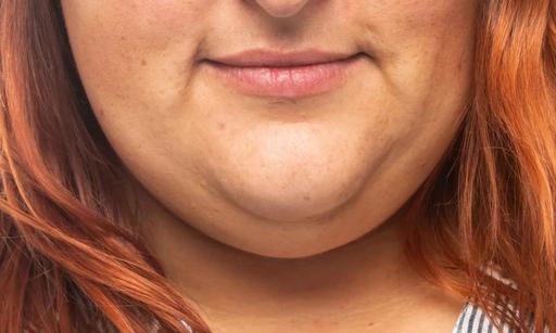 double-chin-1019129216.jpg