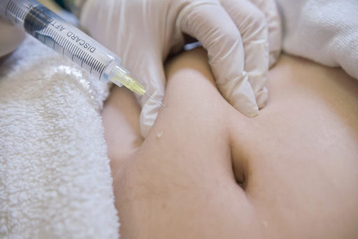 Lipolysis-Purpose-Procedure-and-Side-Effects-scale