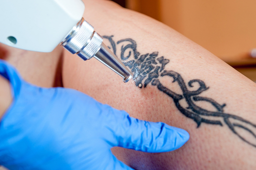 cosmetic-medlite-laser.jpg