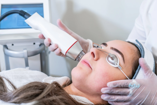 infini-micro-needling-image (1).png