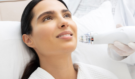 RF-MICRONEEDLING2 (4).jpg