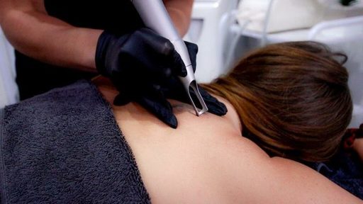 Tattoo-Removal-1024x576.jpg